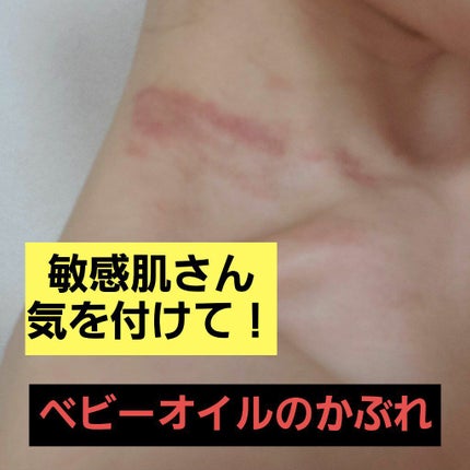 ジョンソンベビーオイル微香性/ジョンソンベビー/ボディオイルを使ったクチコミ(1枚目)