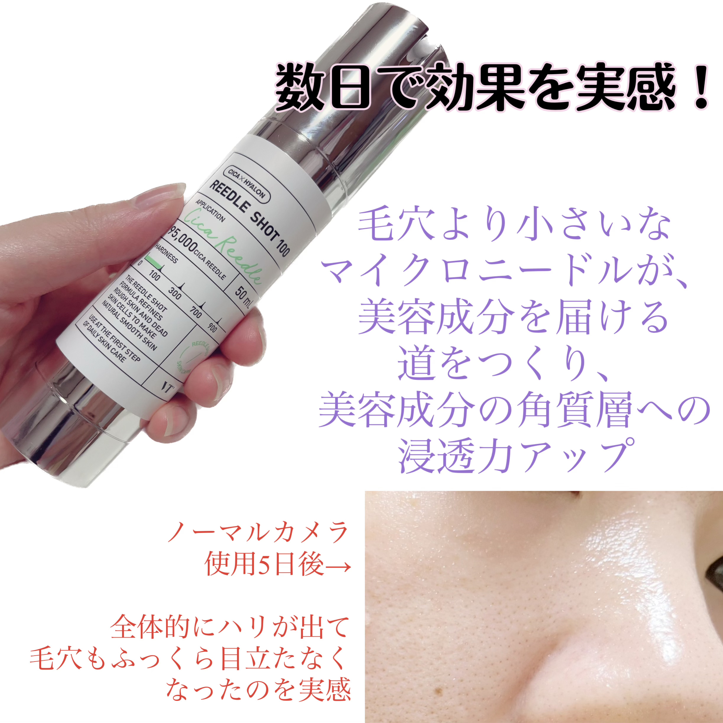 リードルショット100/VT/美容液を使ったクチコミ（3枚目）
