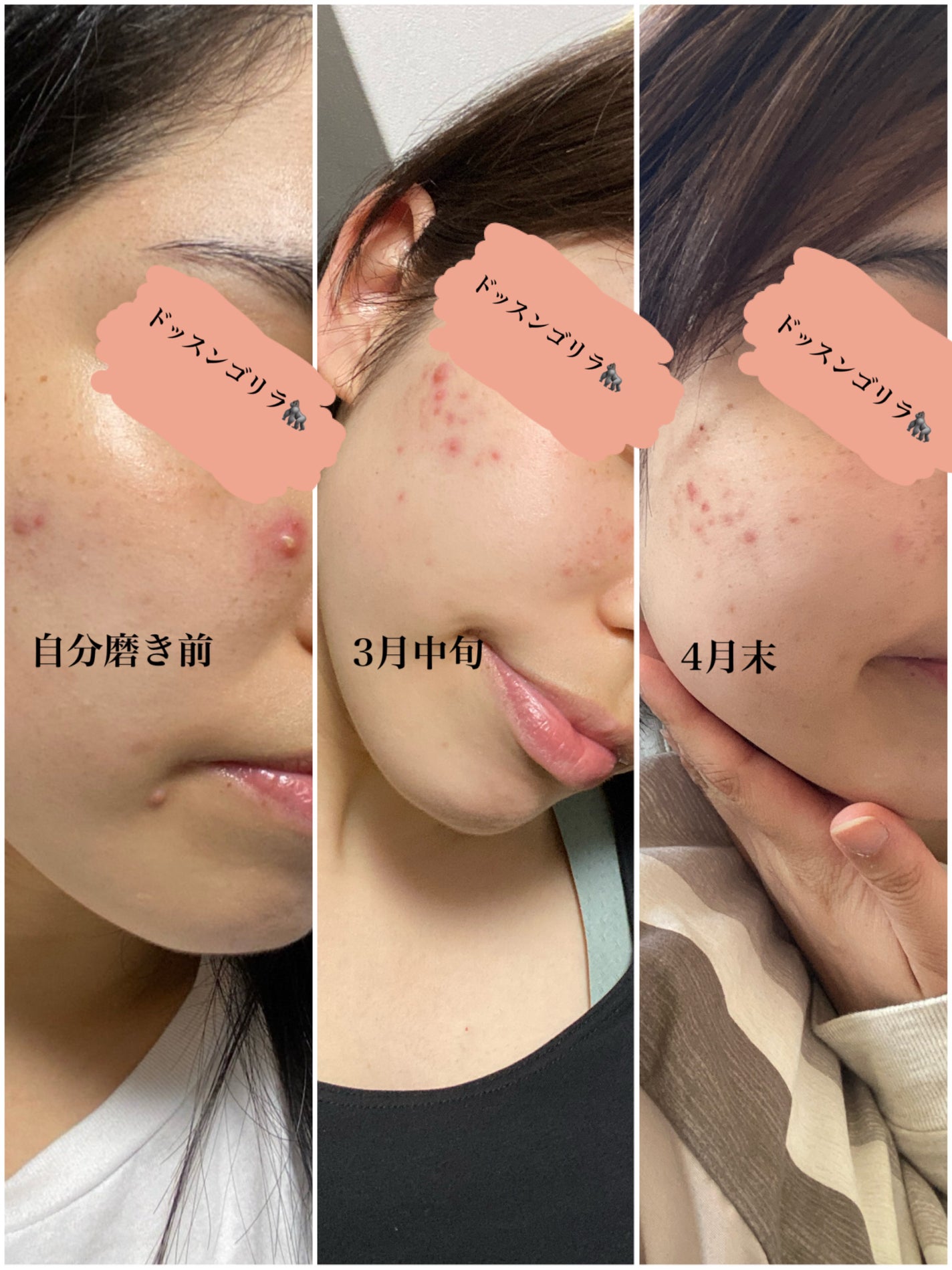 薬用洗顔フォーム しっかりタイプ/クレアラシル/洗顔フォームを使ったクチコミ(2枚目)