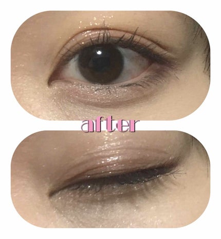 【旧品】オリシキ アイリッドスキンフィルム/D-UP/二重まぶた用アイテムを使ったクチコミ(3枚目)