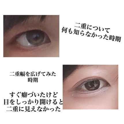 りそうのふたえ くっきりクセづけ/DAISO/二重まぶた用アイテムを使ったクチコミ(2枚目)