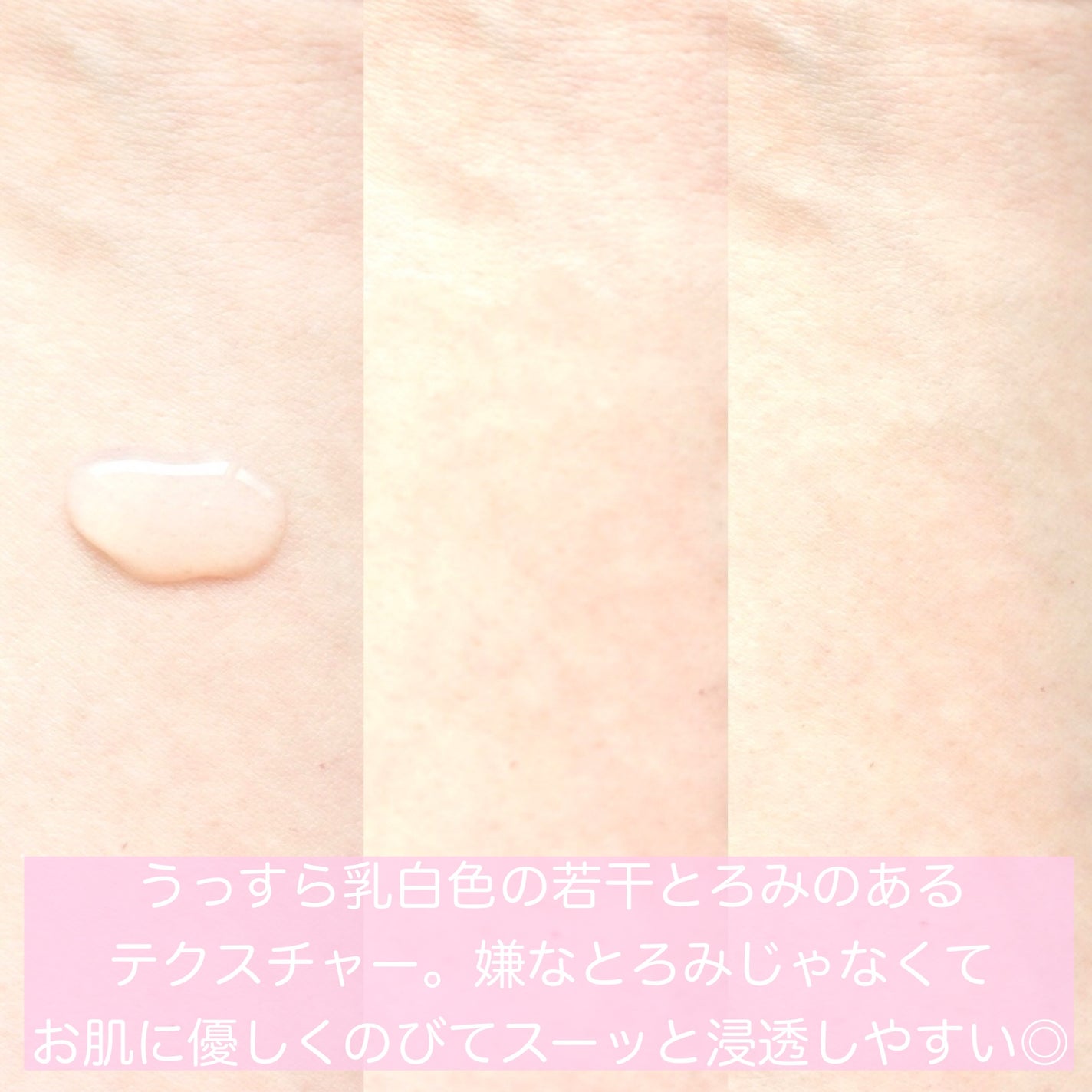 薬用高保湿化粧水/乾燥さん/化粧水を使ったクチコミ(4枚目)