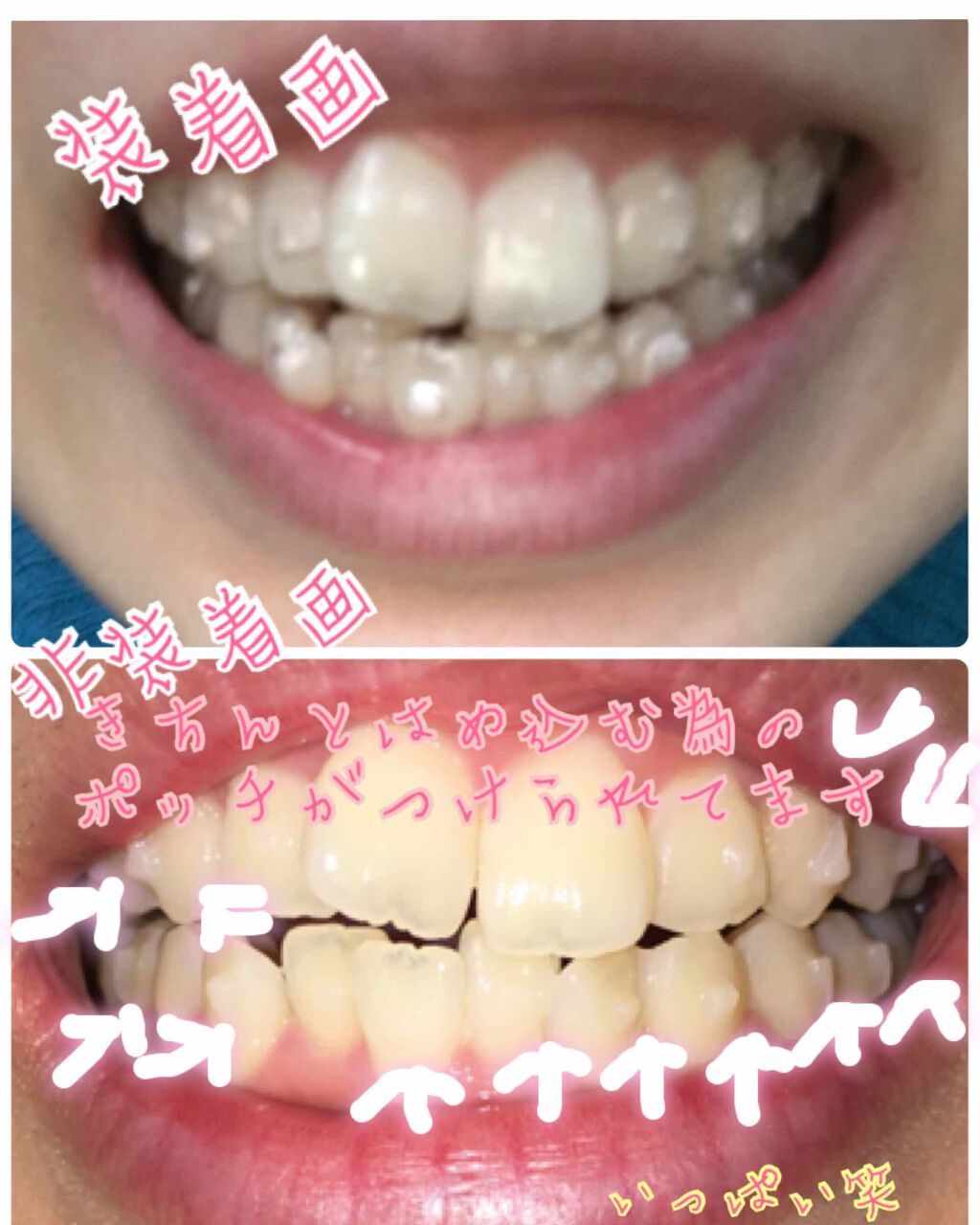 を使ったクチコミ（3枚目）