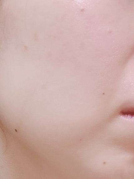 RXザ・ビタミンC23セラム/COSRX/美容液を使ったクチコミ(3枚目)