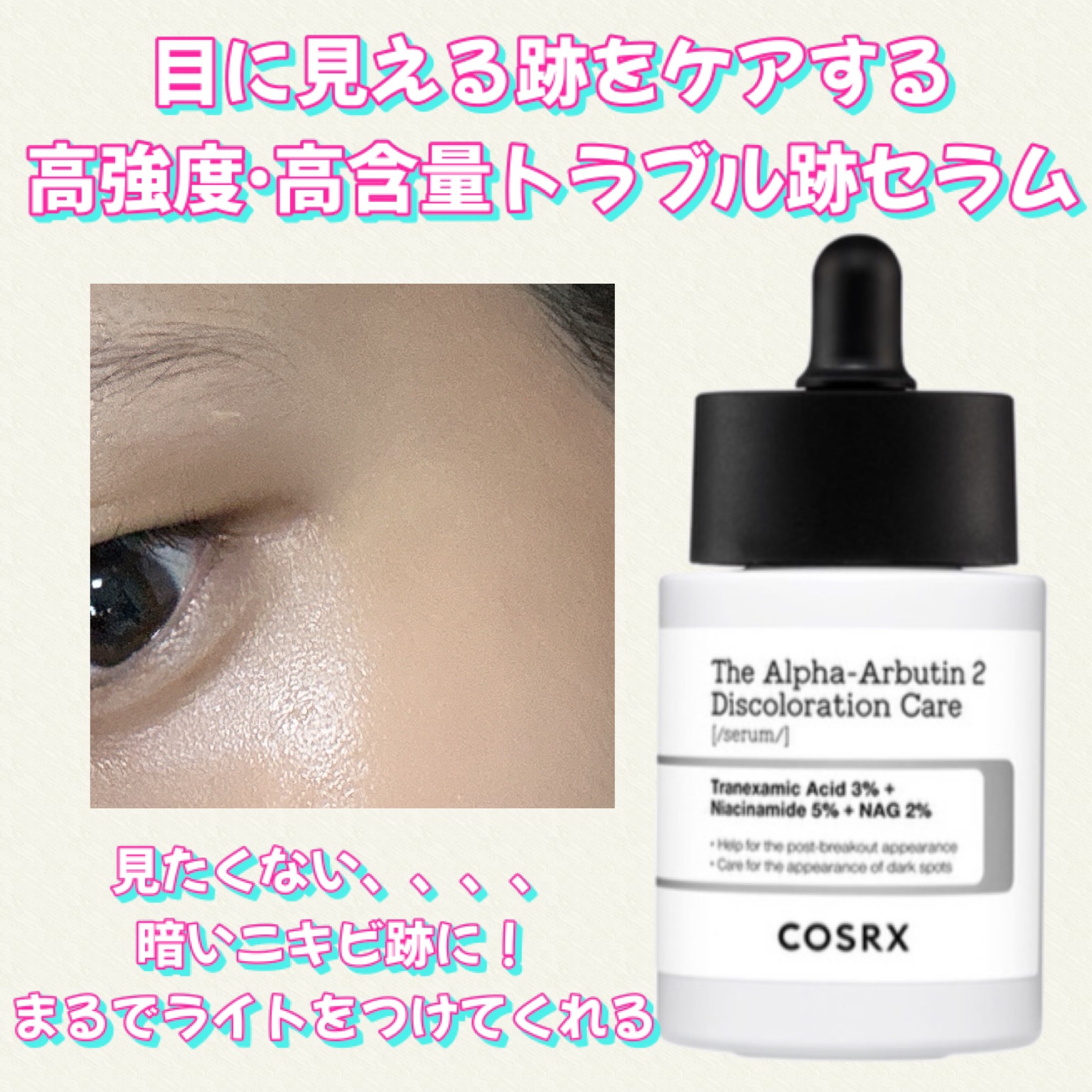 RXザ・アルファアルブチン2 ニキビ跡ケアセラム/COSRX/美容液を使ったクチコミ（3枚目）