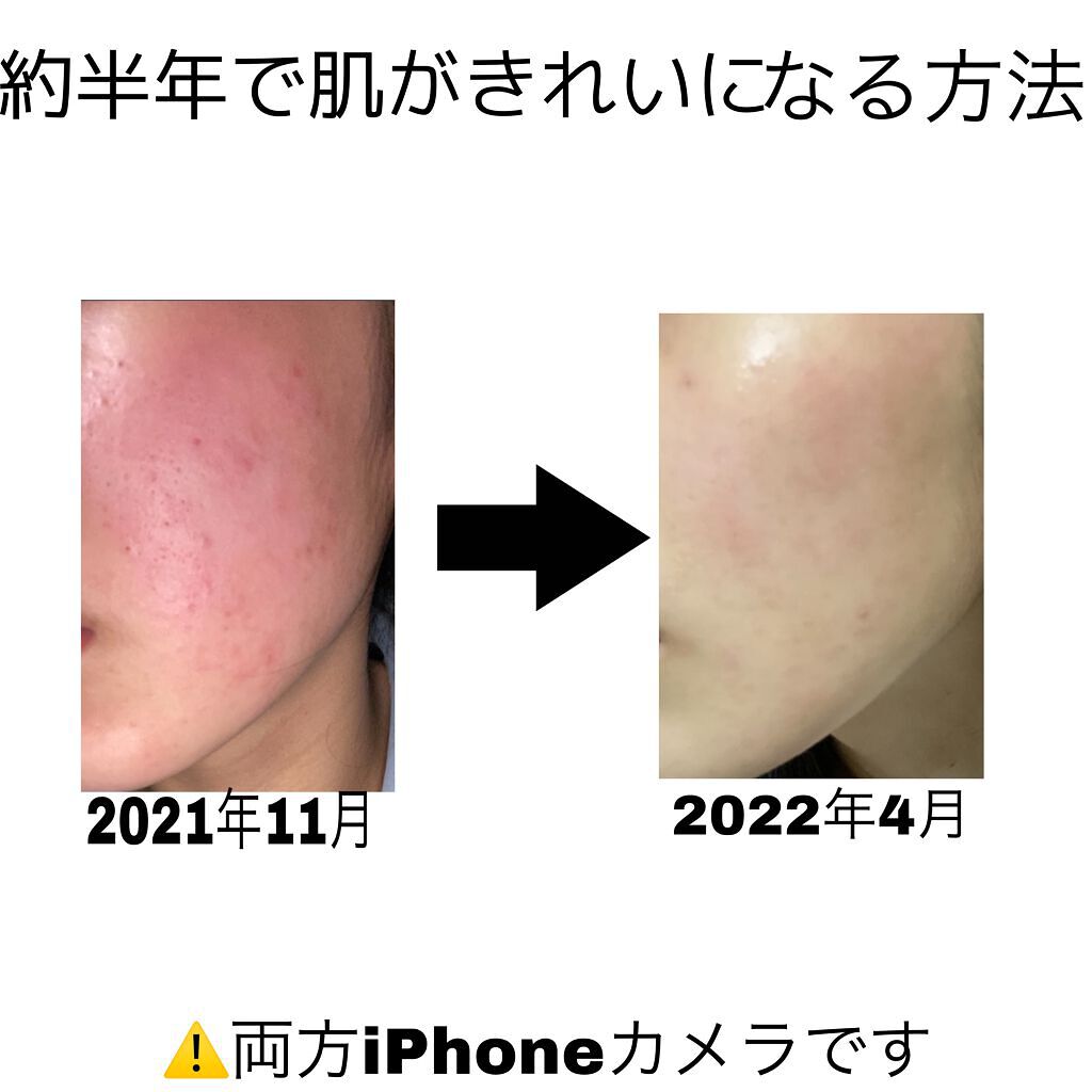 薬用ローション（とてもしっとり）/IHADA/化粧水を使ったクチコミ（1枚目）