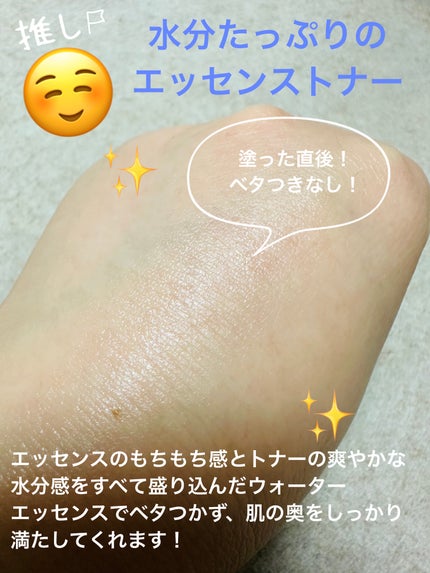 プロバイオシカ エッセンス トナー/SKIN1004/化粧水を使ったクチコミ(4枚目)