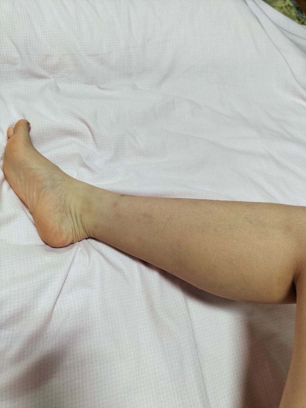 ひなちゃんねる様の脚やせ動画、昨日は2日目でした。

昨日は股関節の筋肉痛凄かった…😂



動画こちらです⬇⬇
https://youtu.be/O5cwCtoWndE
