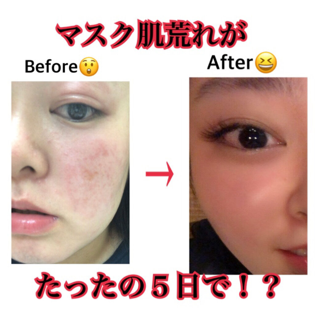 CICA スキン/VT/化粧水を使ったクチコミ（1枚目）