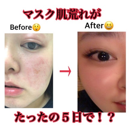 CICA スキン/VT/化粧水を使ったクチコミ(1枚目)