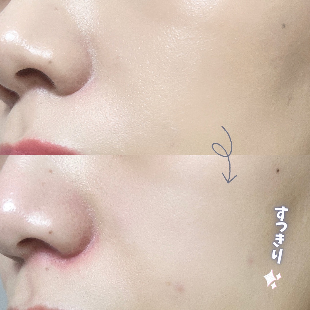 ハイアミノオール クレンジングミルク 200ml/DEWYTREE/ミルククレンジングを使ったクチコミ（3枚目）