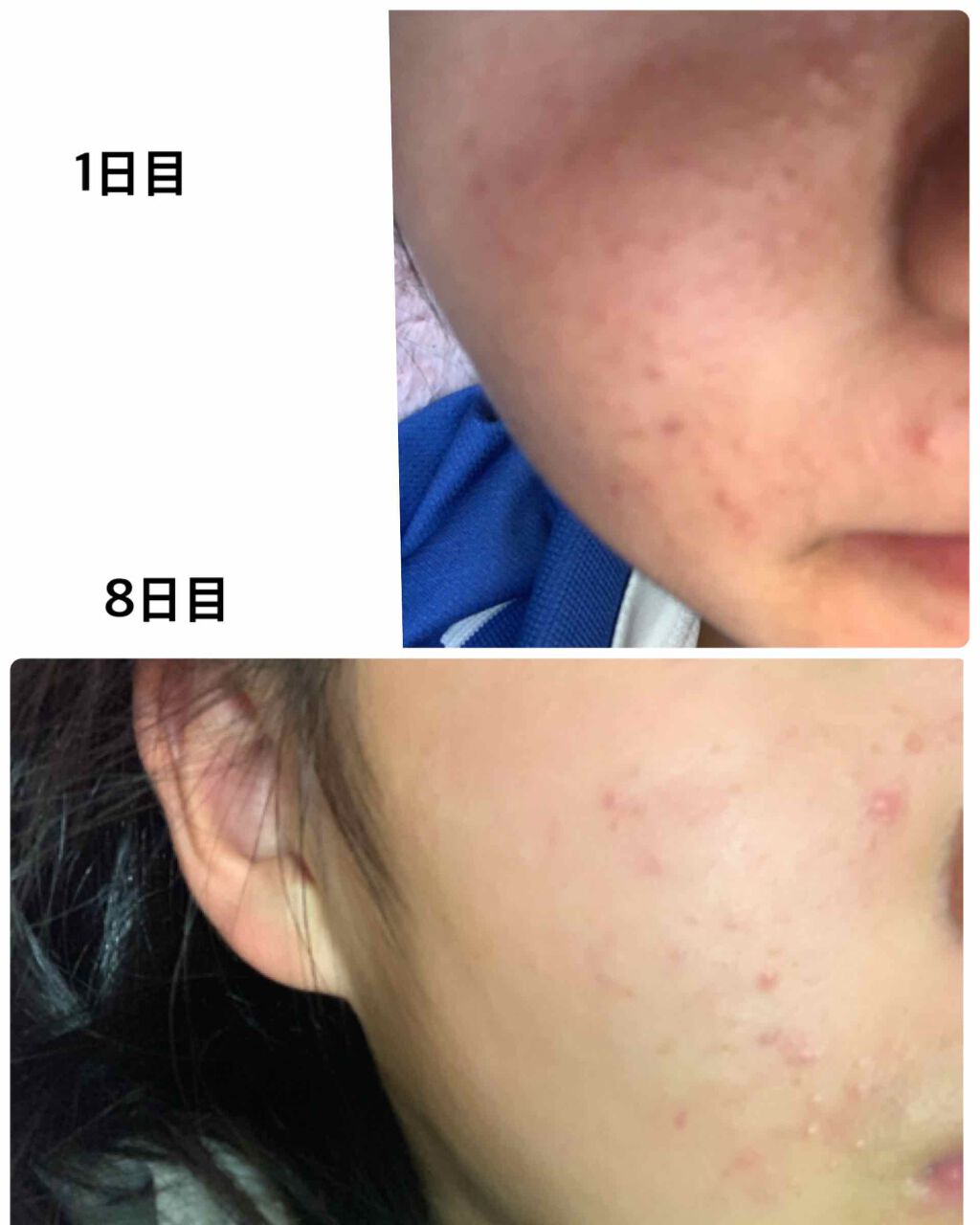 を使ったクチコミ（1枚目）