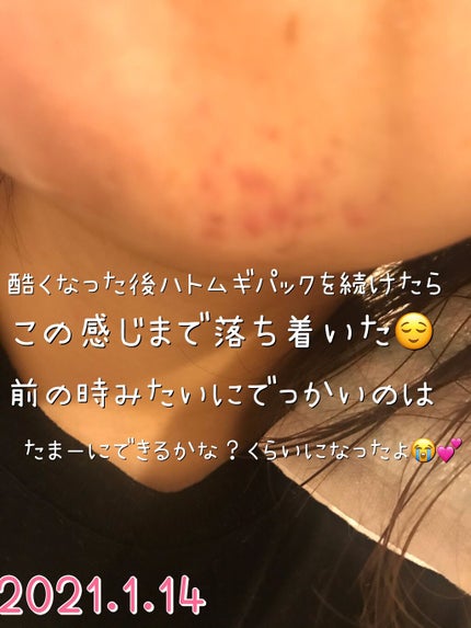 ハトムギ化粧水(ナチュリエ スキンコンディショナー R )/ナチュリエ/化粧水を使ったクチコミ(3枚目)