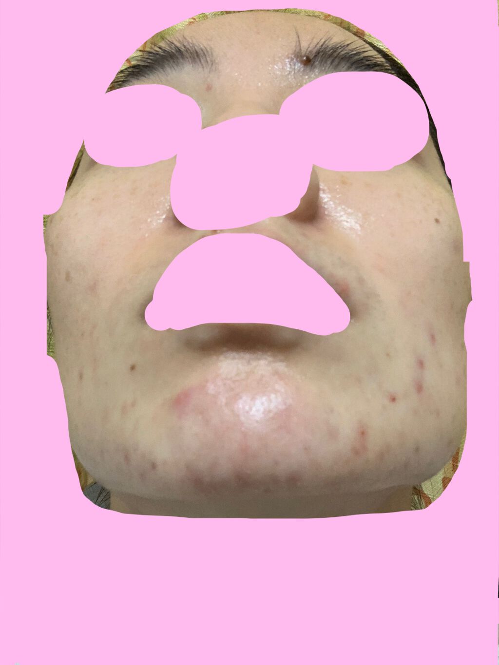 潤浸保湿 化粧水 III とてもしっとり/キュレル/化粧水を使ったクチコミ(8枚目)