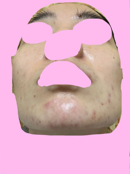 潤浸保湿 化粧水 III とてもしっとり/キュレル/化粧水を使ったクチコミ(8枚目)