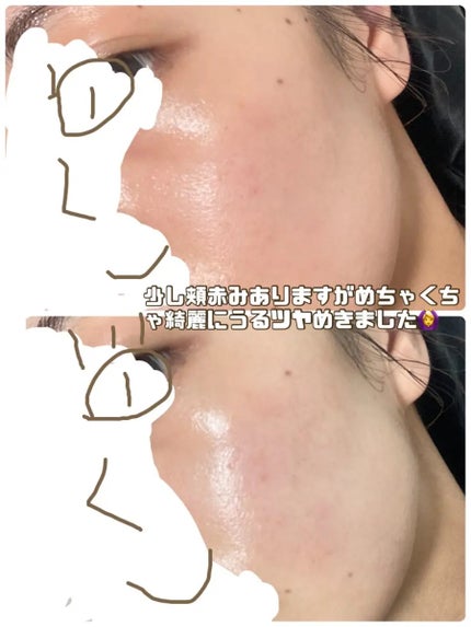 モイストチャームマスク 無香料/nookμ/シートマスク・パックを使ったクチコミ(4枚目)