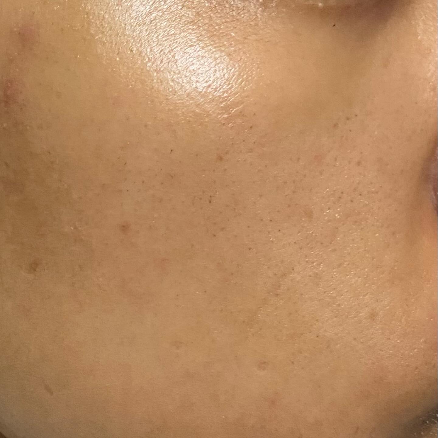 ペンタショット/CELORABY/美顔器・マッサージを使ったクチコミ（3枚目）