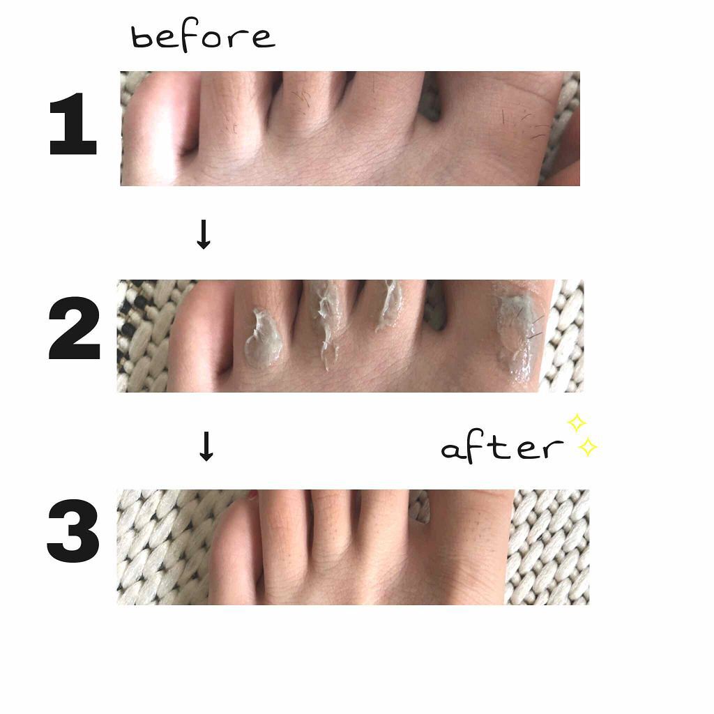 タラソボーテエピクリーム/ヴィーナスラボ/除毛クリームを使ったクチコミ(2枚目)