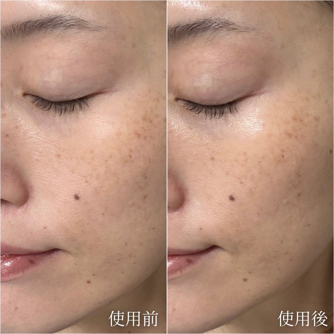 トワニー タイムリフレッシャー/TWANY/美容液を使ったクチコミ(3枚目)