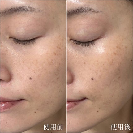 トワニー タイムリフレッシャー/TWANY/美容液を使ったクチコミ(3枚目)