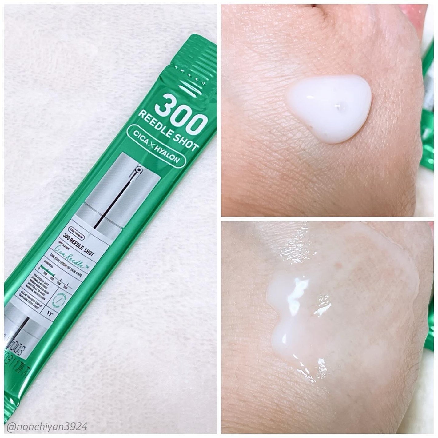 シカレチA エッセンス0.1/VT/美容液を使ったクチコミ(4枚目)