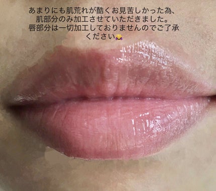 フルーツ リップバーム N/JILL STUART/リップケアを使ったクチコミ(2枚目)