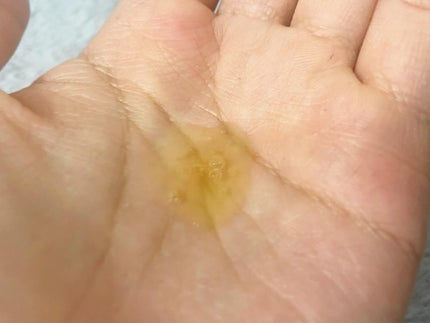 Ultra Whitening Perfect Ampoule/MIGUHARA/美容液を使ったクチコミ(9枚目)