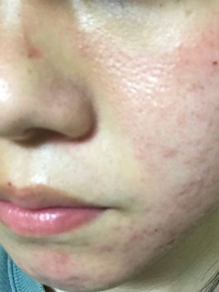 ãšããã¥ãªã²ã«/ãã«ãæ ªåŒäŒç€Ÿ/ãã®ä»ã䜿ã£ãã¯ãã³ãïŒ2æç®ïŒ