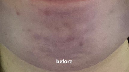 TIRTIR(ティルティル) マスクフィットクッションのクチコミ「『ファンデ』
ゆんです!
今日は佐藤勝利くんがCMキャラクターをやってて気になって買った、.....」(2枚目)