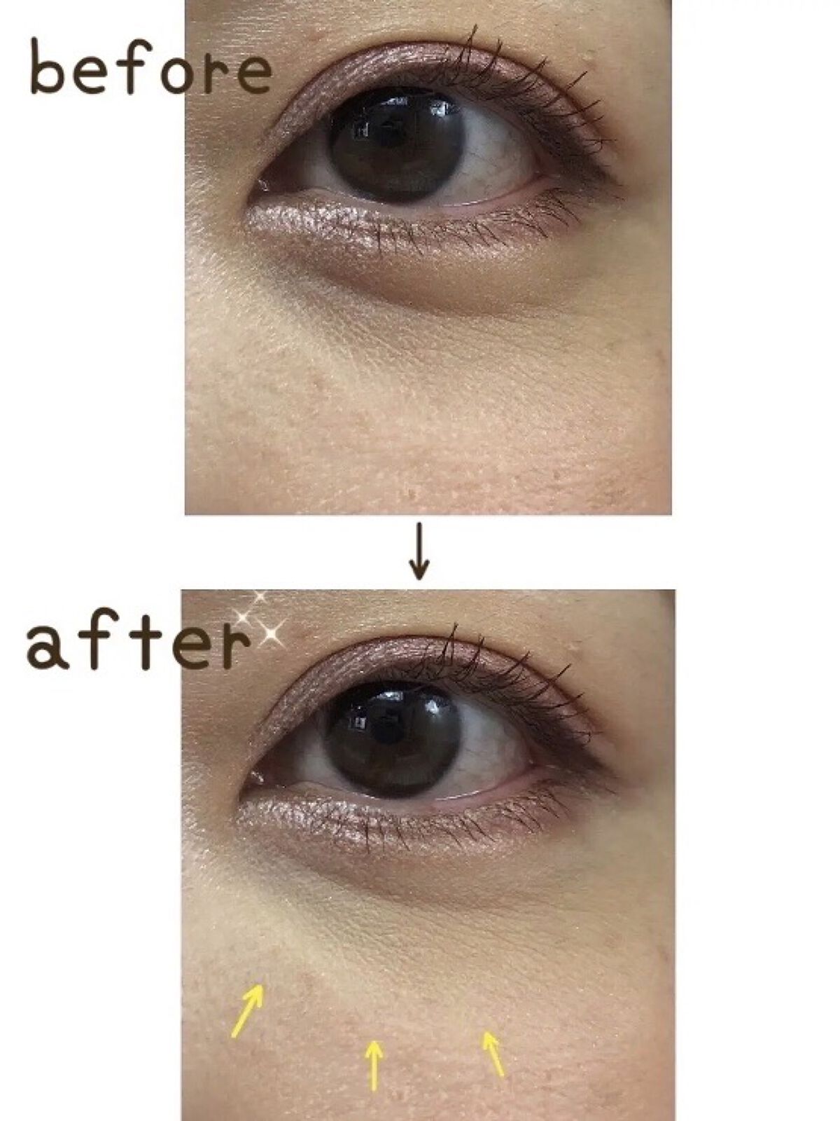 ディエム クルール カラーブレンドパウダーコンシーラー/ディエム クルール/パウダーコンシーラーを使ったクチコミ（2枚目）