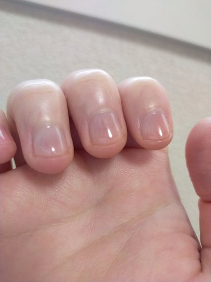 ジェルボリュームトップコート/キャンメイク/ネイルトップコートを使ったクチコミ(4枚目)