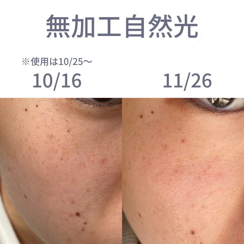 リジュブネイトエキス|インナーシグナルの効果に関する口コミ リジュブネイトエキス|インナーシグナルの効果に関する口コミ