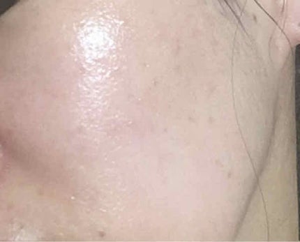 タカミスキンピール/タカミ/ブースター・導入液を使ったクチコミ(4枚目)