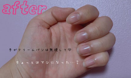 エテュセ クイックケアコート/ettusais/ネイルオイル・トリートメントを使ったクチコミ(3枚目)