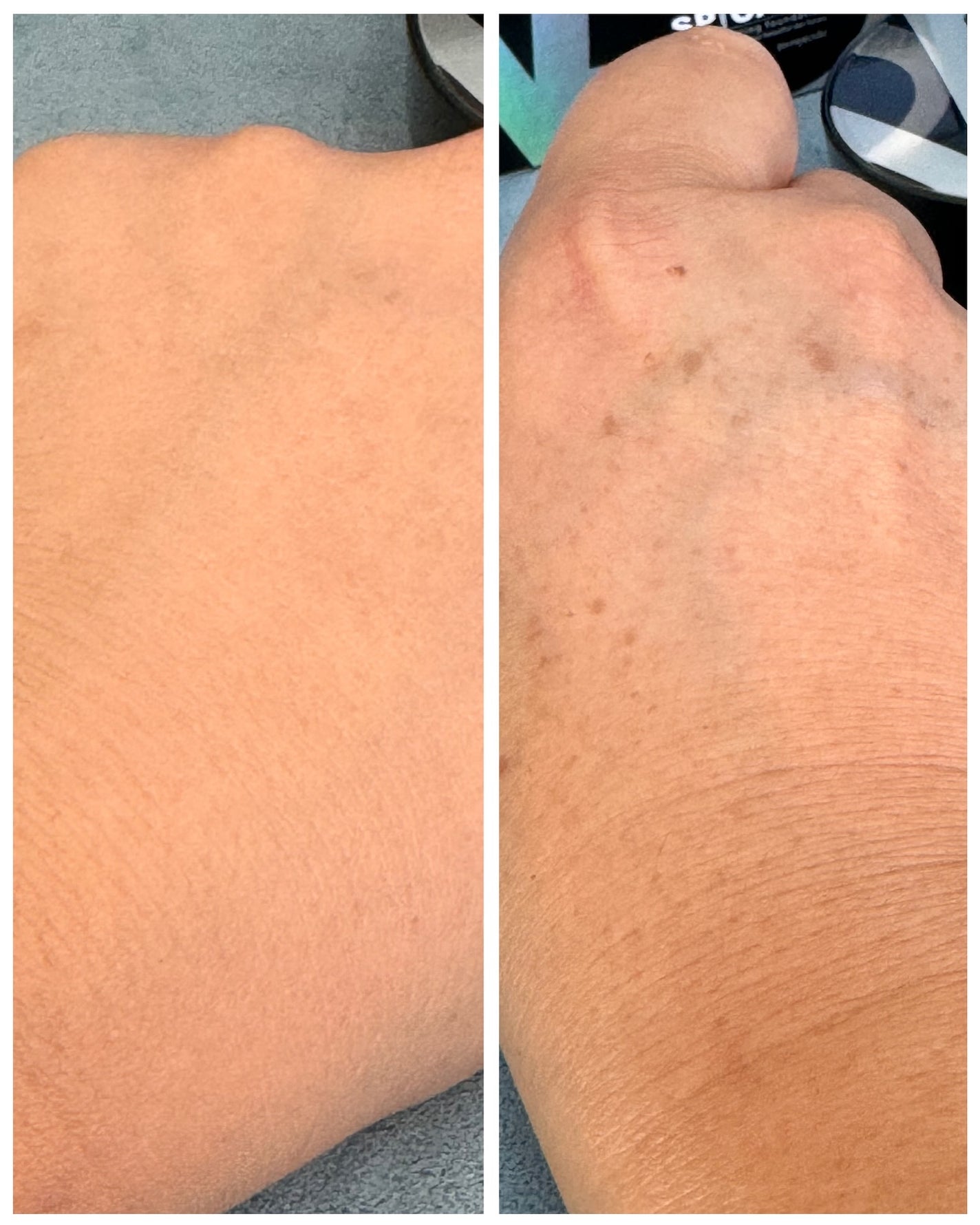 V3 エキサイティングファンデーション/SPICARE/クッションファンデーションを使ったクチコミ(6枚目)