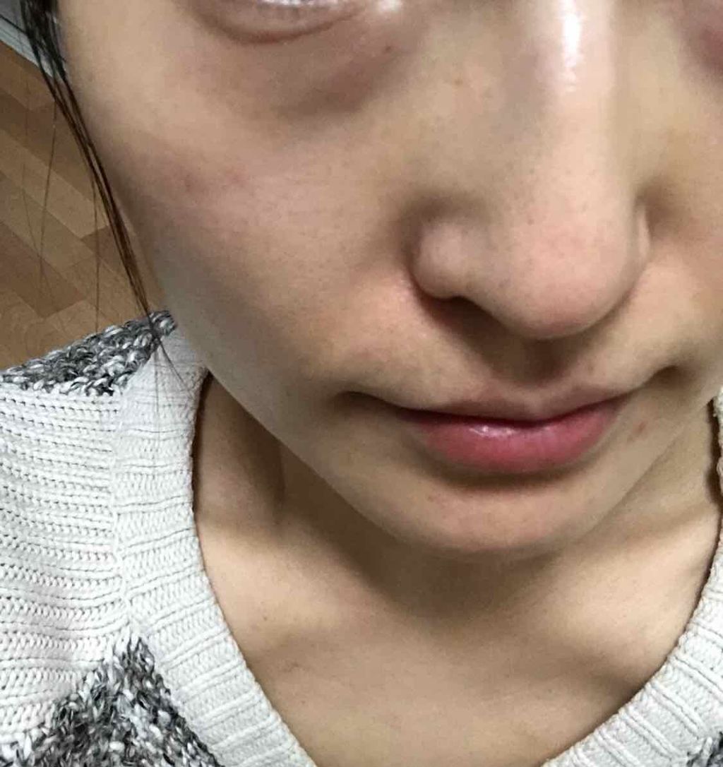 スチーマー ナノケア/Panasonic/美顔器・マッサージを使ったクチコミ（3枚目）