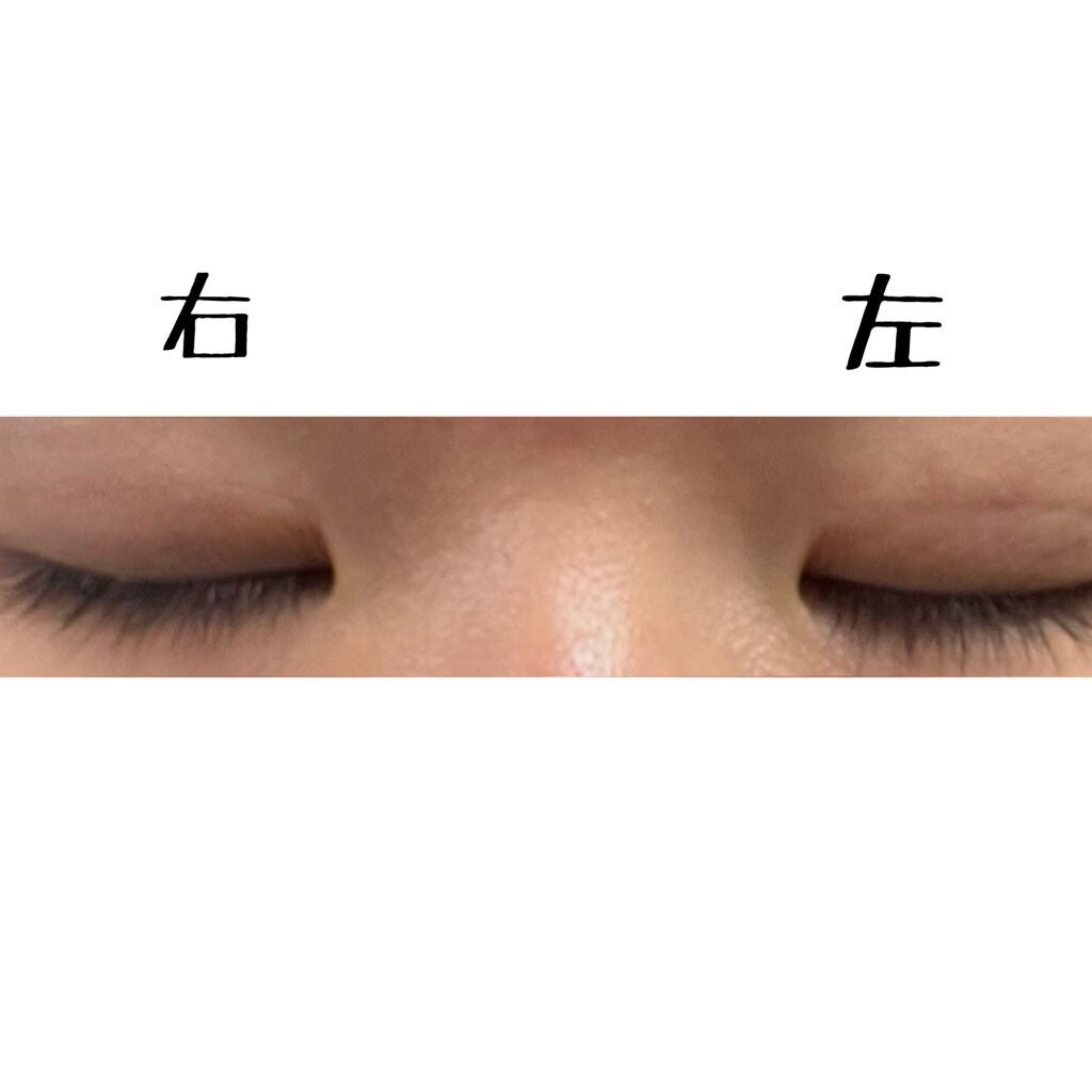 ïŸïŸð on LIPS ãããã«ã¡ã¯ãããã§ãð3æ¥ç®ã§ãïŒïŒä»æ¥ã®ç¶æ
ã¬ãããŠãããŸã..ãïŒ2æç®ïŒ