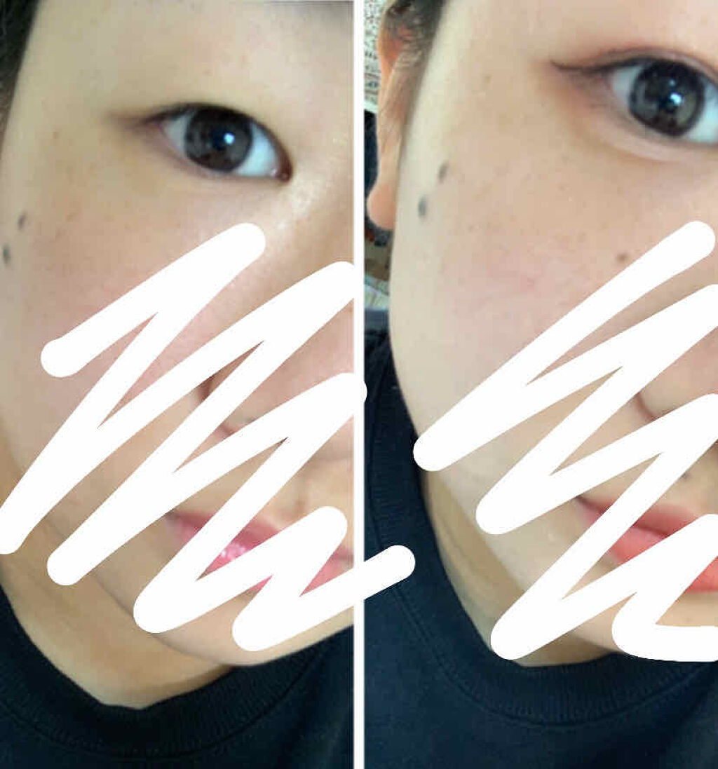 【旧品】オリシキ アイリッドスキンフィルム/D-UP/二重まぶた用アイテムを使ったクチコミ（3枚目）