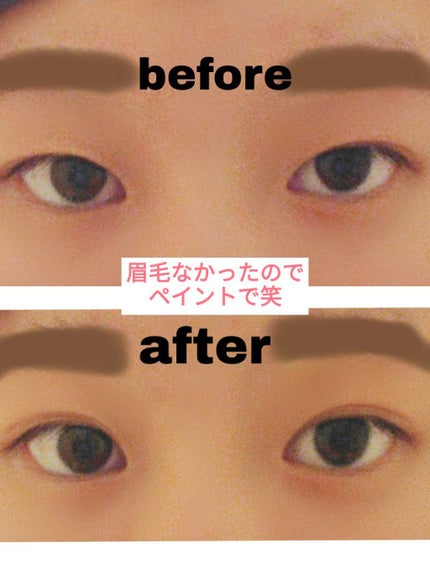 TWOOL ダブルアイリッドグルー/SHOBIDO/二重まぶた用アイテムを使ったクチコミ(3枚目)