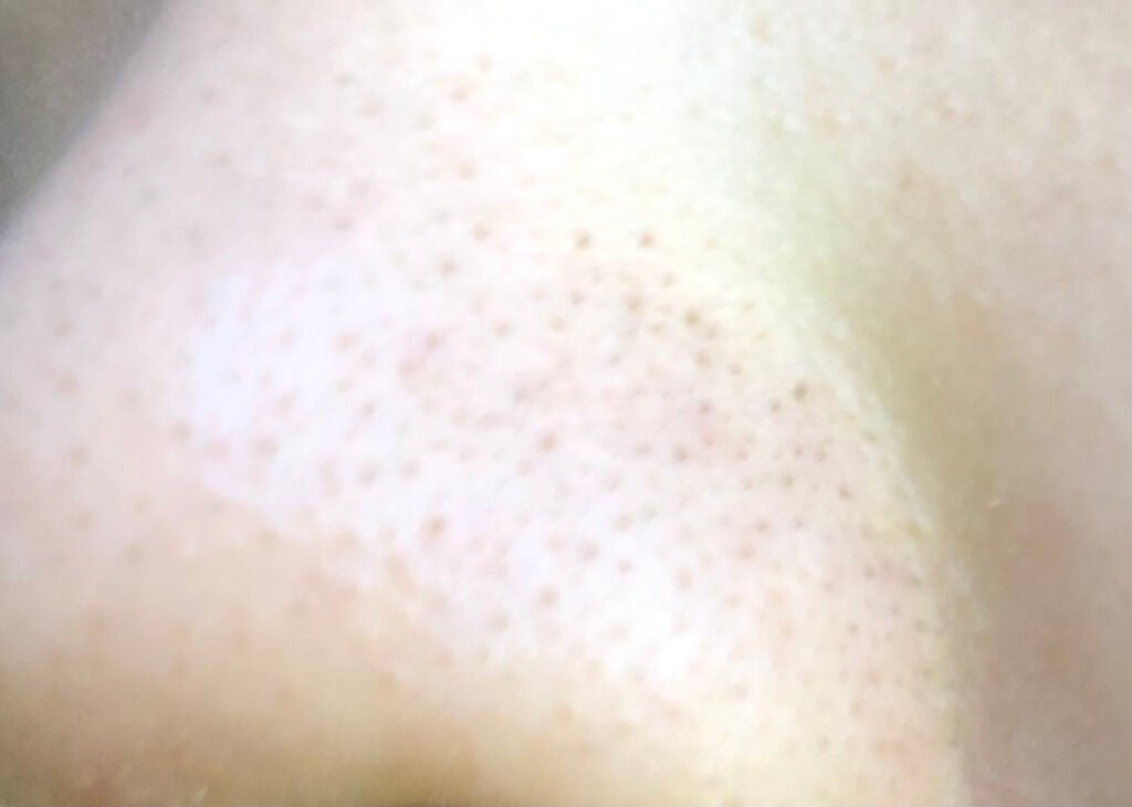 女子力低めのさくらんぼ on LIPS 「皆さん助けてー何しても治らない黒ずみ毛穴治す方法を教えて下さい..」(4枚目)