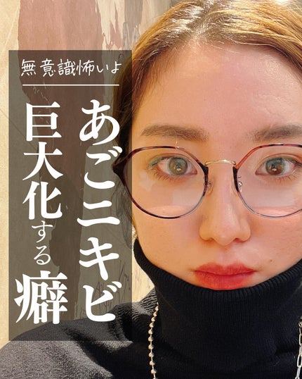 おゆみ|ニキビ・ニキビ跡ケア on LIPS 「【無意識に触ってない?】これに尽きる…!私もそうだったのですが..」(1枚目)