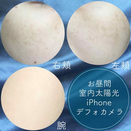 ホワイトCクリア(医薬品)/トランシーノ/その他を使ったクチコミ(2枚目)
