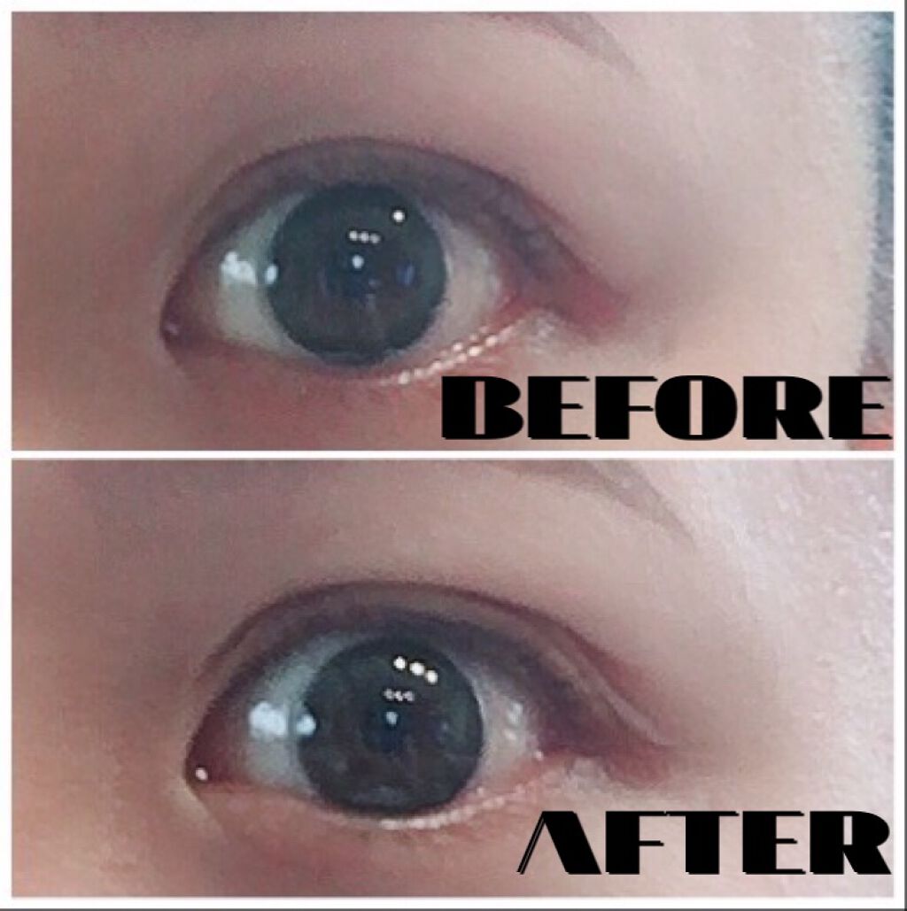 ワンダーアイリッドテープ Extra/D-UP/二重まぶた用アイテムを使ったクチコミ(1枚目)