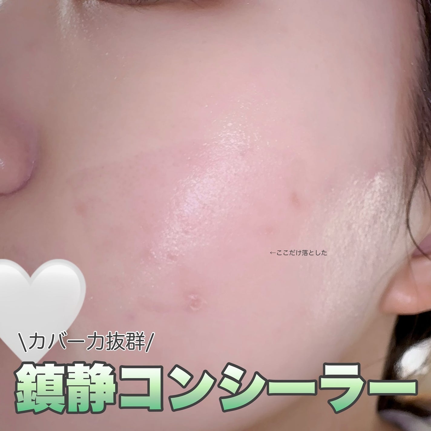 ダーマシンコンシーラー/23years old/リキッドコンシーラーを使ったクチコミ(1枚目)