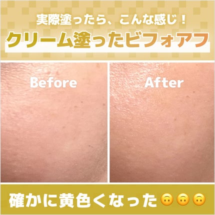 トラネキサム酸6%クリーム/DERMA FACTORY/フェイスクリームを使ったクチコミ(4枚目)