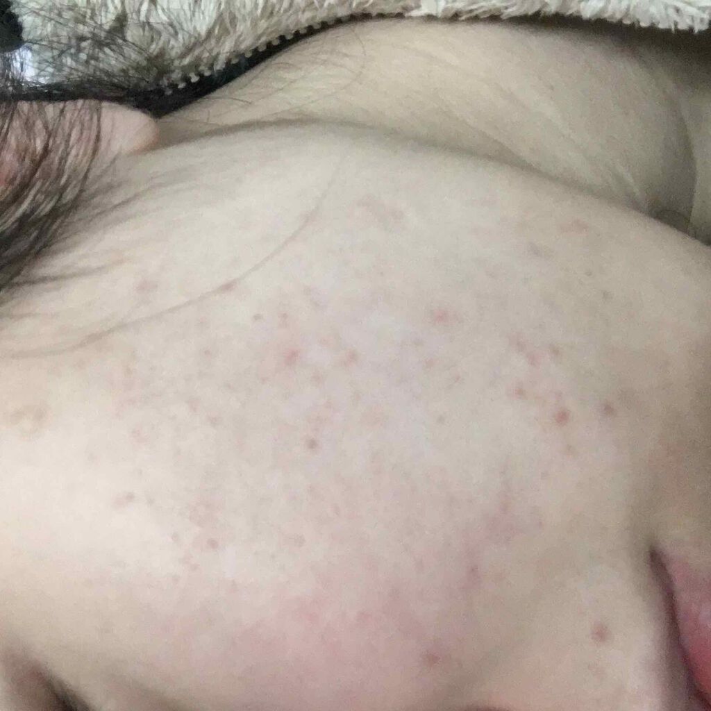 まっぷち on LIPS 「このコロナ休みで肌ピカピカにしてえ??肌めちゃ綺麗やん!!を次..」(2枚目)