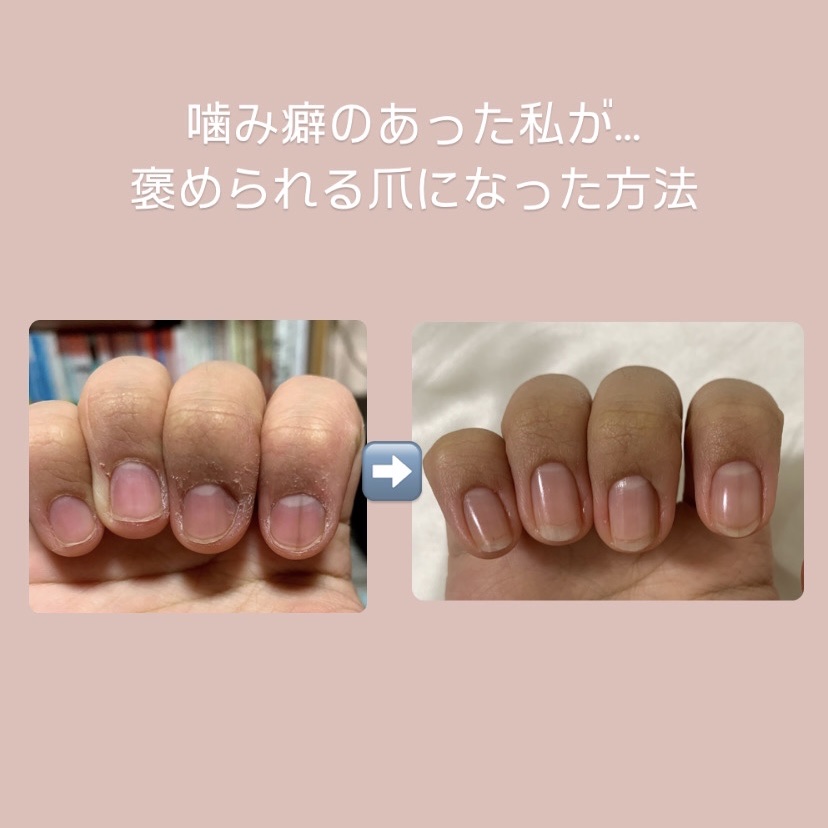 オイルインキューティクルプッシャーペン/ビューティーワールド/ネイル用品を使ったクチコミ（1枚目）