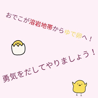 皆様のおでこ、治安いいですか？

私は…今まで悪すぎて悪すぎていいときがないくらい悪かったんです。

どのくらい悪かったかというとコンビニがトイレ貸してくれないくらい悪かったです。


しかしお母さんに