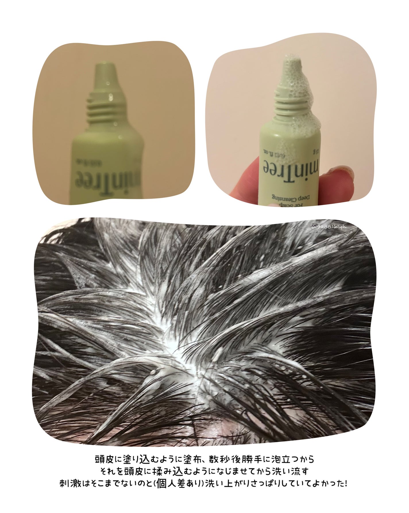 スパークリングスカルプスケーラー/ミンツリー/頭皮ケアを使ったクチコミ(5枚目)