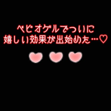 ベピオゲル経過記録パート2😆💕

以前の投稿から変化があったので記録🧐🧐

ベピオゲルを塗った後に副作用であるピリピリ感はまだ多少あるものの1、2時間程で収まるように！！！🤩🤩

やっと肌がベピオゲルに